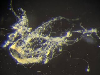 thumbnail - Electric Bacteria