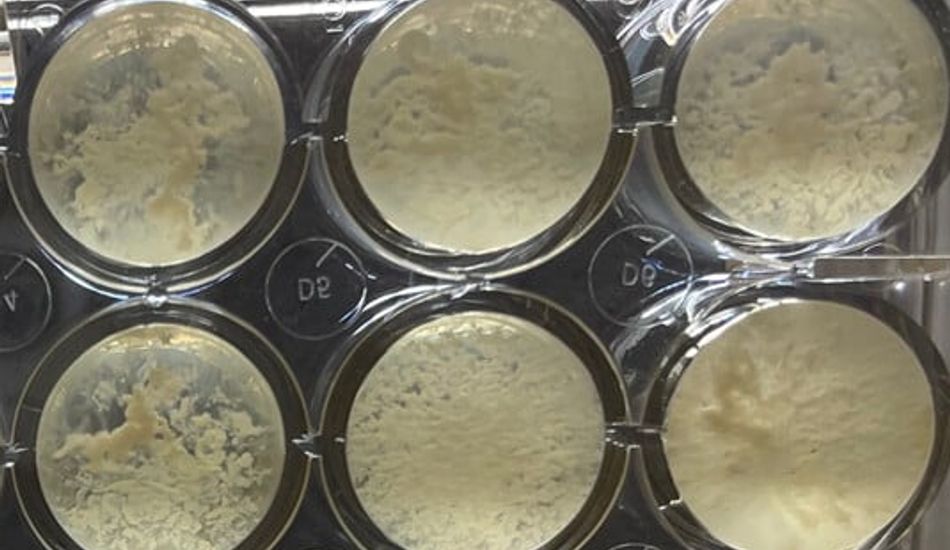 imageMicrobe Survival