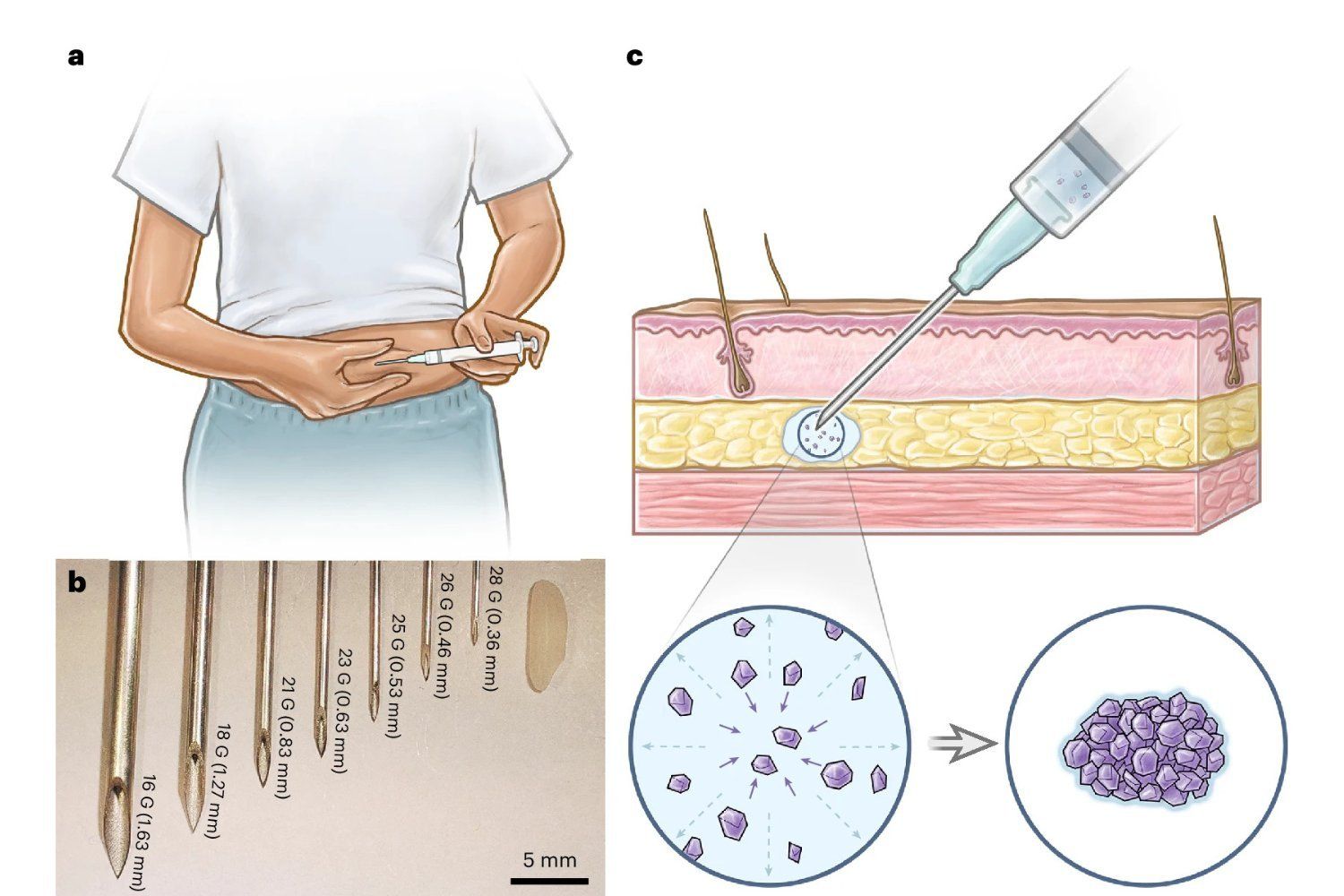 Contraceptive Implant