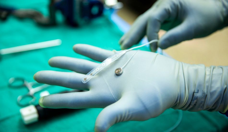 Brain Implant Tech