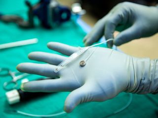 thumbnail - Brain Implant Tech