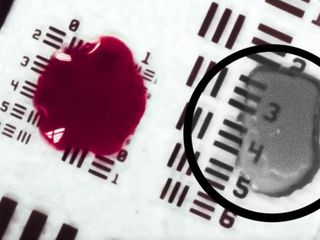 thumbnail - AI Surgery